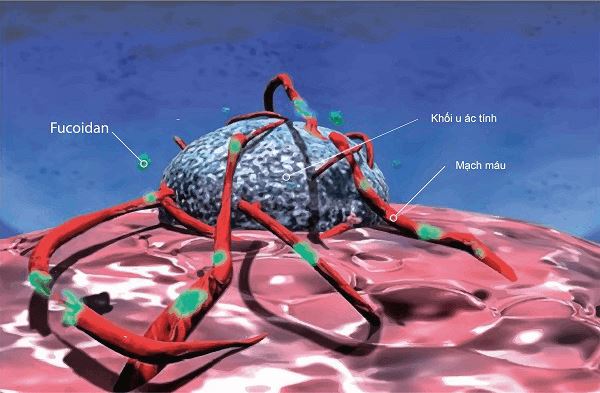 Fucoidan hỗ trợ giảm đau ung thư giai đoạn cuối