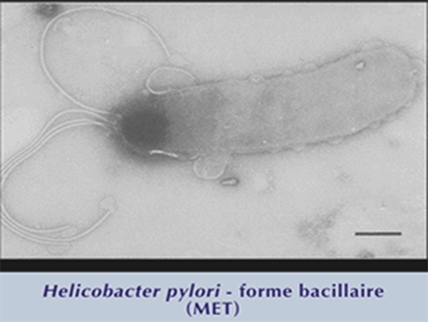 Hình ảnh vi khuẩn HP