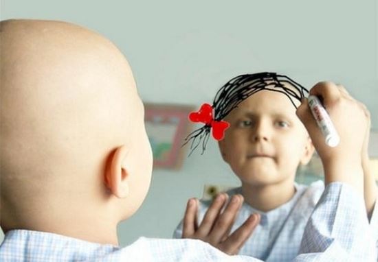 Tác dụng phụ hay gặp của hóa trị là rụng tóc