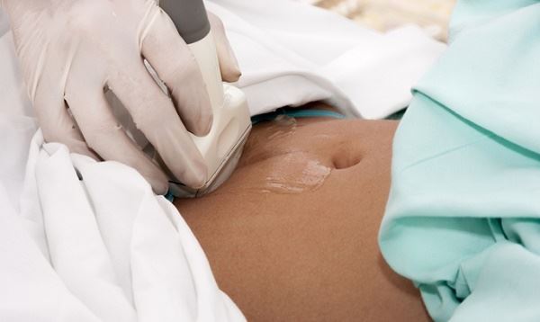 siêu âm chẩn đoán ung thư buồng trứng