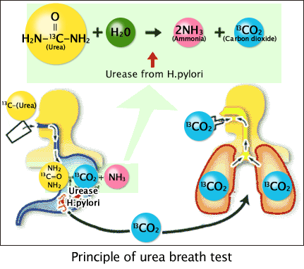 Test thở tìm vi khuẩn HP