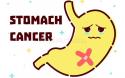 Nguyên nhân và Cách phòng ngừa ung thư dạ dày Nguyên nhân và Cách phòng ngừa ung thư dạ dày